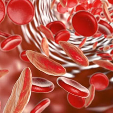 Anaemia Mini Profile