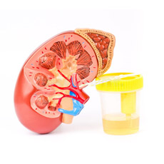 Kidney Function Mini Profile