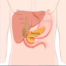 Pancreatic Profile