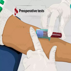 Pre-Operative Maxi Profile