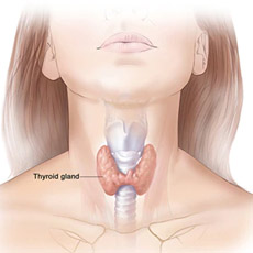 Thyroid Profile -IV