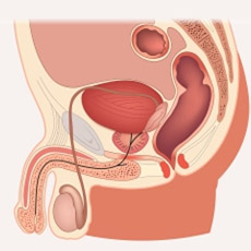 Testicular cancer profile