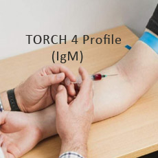 TORCH 4 Profile (IgM)