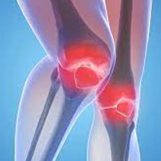 Arthritis Profile