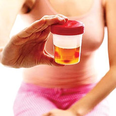 Urine Infection Screen