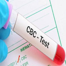 Complete Blood Count (CBC)